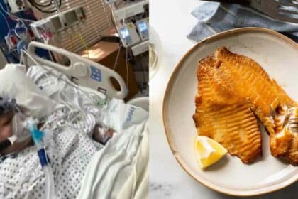 Wanita Kudung Kaki Dan Tangan Gara-Gara Makan Ikan Tilapia 'Separuh Masak'
