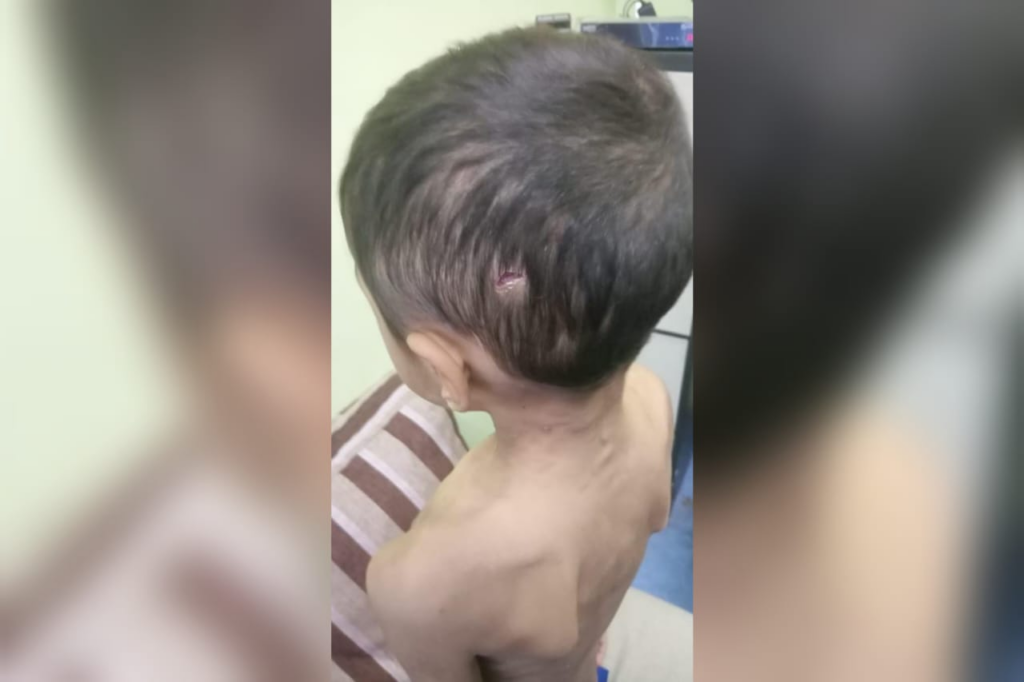 Lagi Kes Dera, Budak 6 Tahun Lari Rumah Tak Tahan Dipukul Bapa Kandung Dan Ibu Tiri