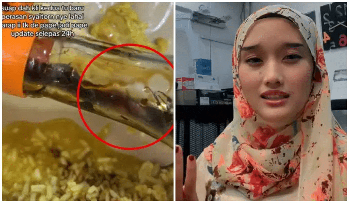 Tengah Sedap Makan, Wanita 'Loya Tekak' Jumpa 3 Ekor Lipas Dalam Botol Kicap Di Kedai Makan