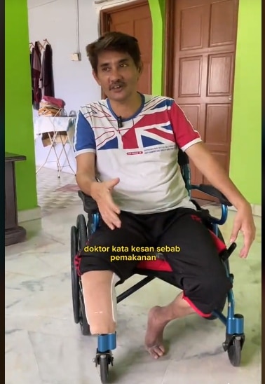 Gemar Minum Teh Tarik, Individu Ini Kongsi Tabiat Pemakanan Sampai Kaki Terpaksa Dipotong