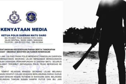Lelaki Cedera Parah, Nyaris Putus Tangan Selepas Ditetak Dengan Parang Di Matu