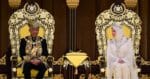 Raja Permaisuri Agong Berkenan Jadikan Anak Sarawak Hidap Sindrom Werewolf Ini Sebagai Anak Angkat