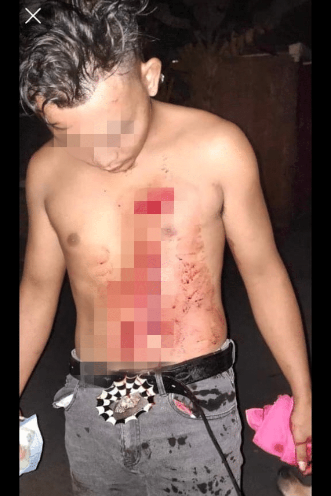 Niat Membantu Bertukar Tragedi, Lelaki Diserang Dengan Kerambit Oleh 2 Individu Di MJC