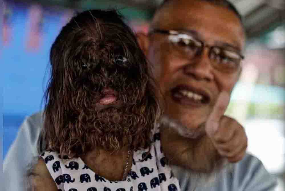 Ambil Anak Angkat Istimewa Di Bintulu, Raja Permaisuri Agong Mahu Terus Tanggung Missclyen