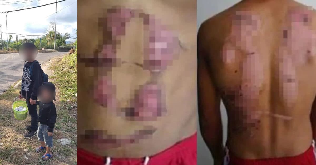 Berpanas Jual Burger, Netizen Bongkar Rupanya Dua Beradik Di Keningau Didera Ibu Bapa