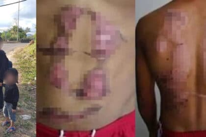 Berpanas Jual Burger, Netizen Bongkar Rupanya Dua Beradik Di Keningau Didera Ibu Bapa