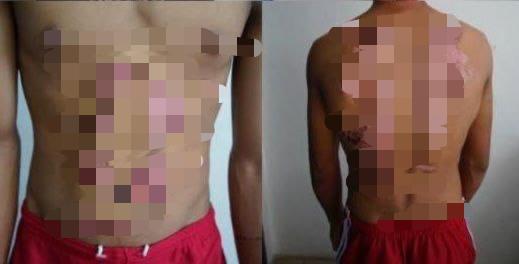 Berpanas Jual Burger, Netizen Bongkar Rupanya Dua Beradik Di Keningau Didera Ibu Bapa