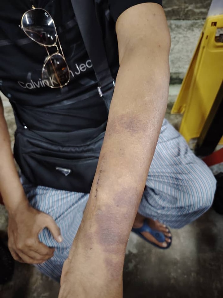 Kes Lelaki Dipukul Di MJC Batu Kawa, Suspek Akhirnya Ditangkap Di Matang