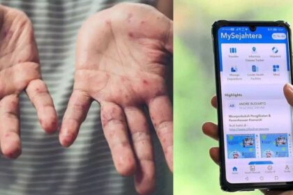 Siap Sedia Hadap Wabak Mpox, Pakar Cadang Penggunaan MySejahtera Semula