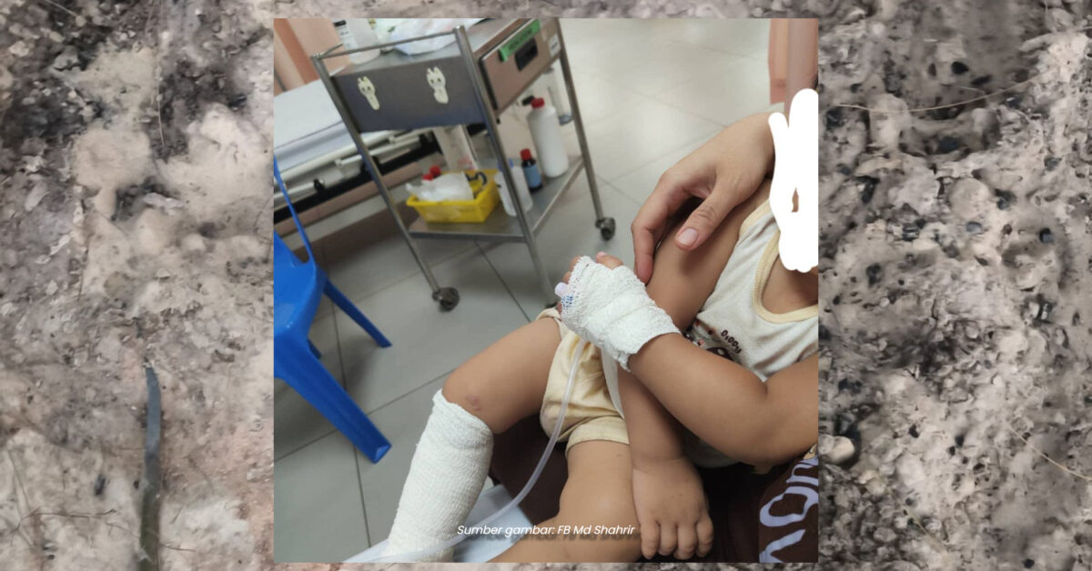 Individu Luah Kesal Kaki Anak Melecur Angkara Sikap Cuai Pengunjung Di Sabah