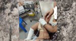 Individu Luah Kesal Kaki Anak Melecur Angkara Sikap Cuai Pengunjung Di Sabah
