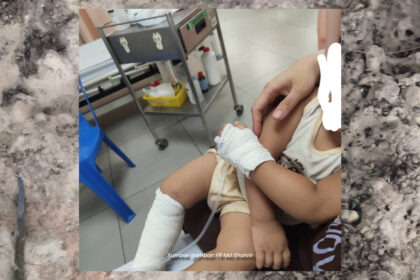 Individu Luah Kesal Kaki Anak Melecur Angkara Sikap Cuai Pengunjung Di Sabah