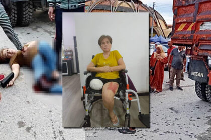 Tular Wanita Dilanggar Lori Di Lawas Hingga Putus Kaki, Mahukan Keadilan
