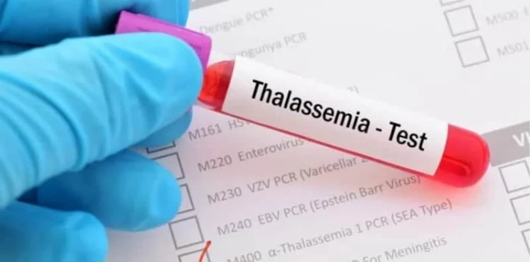 Kerajaan Sabah Disaran Bawa Teknologi Dan Kepakaran Rawatan Thalasemia Dari Luar Negara